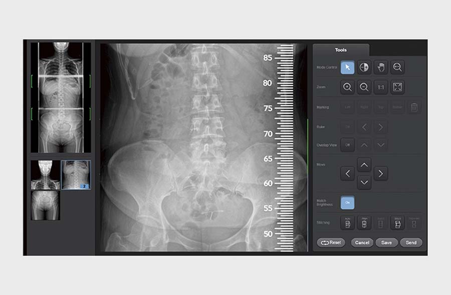 邦楽 X-RAY GR40CW Radiography Retrofit | Samsung Healthcare